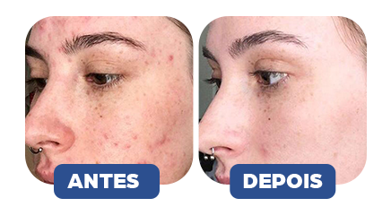 ANTES E DEPOIS 1